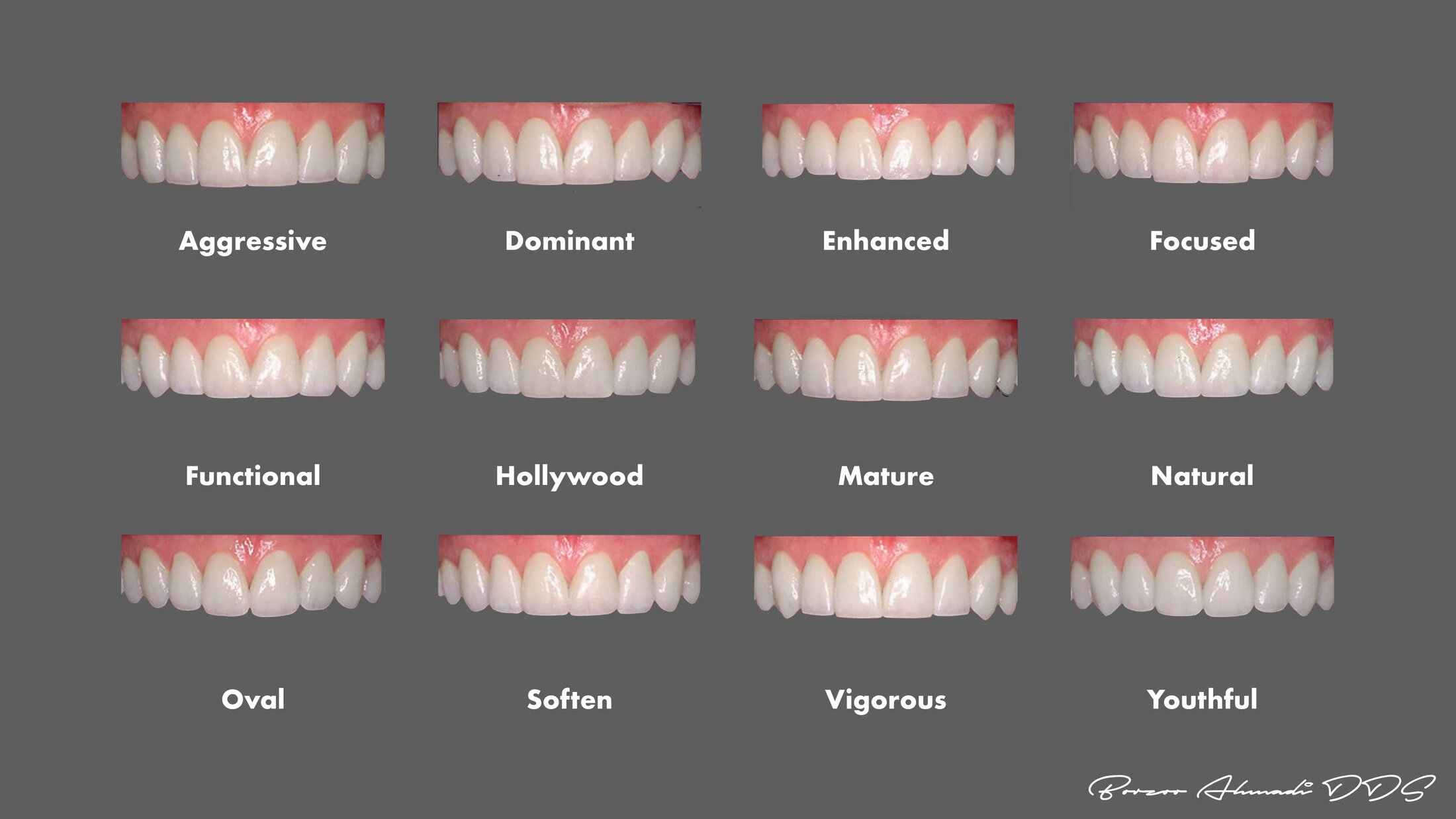 Smile Design West Hollywood Dr Borzoo Ahmadi DDS Smile Design West Hollywood Dr Borzoo Ahmadi DDS