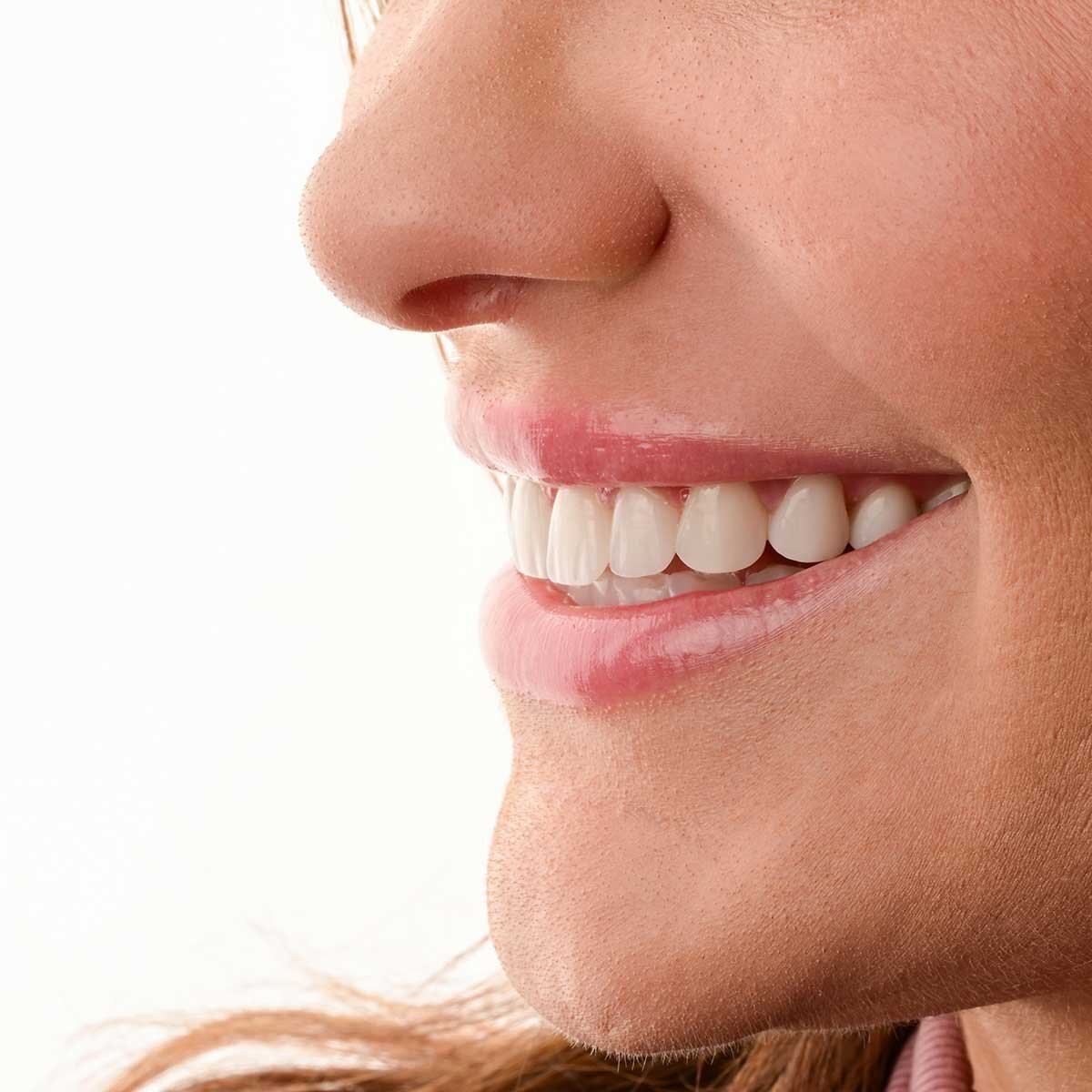 Porcelain Veneers West Hollywood and Beverly Hills